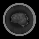 Stress-Free achievement