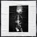 X-Ray